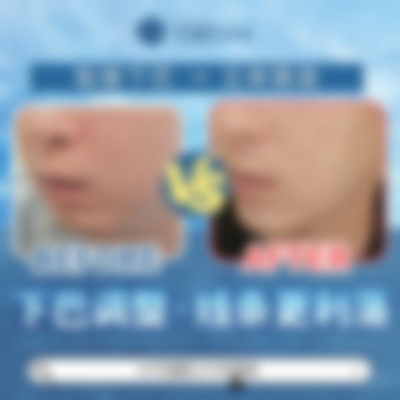 术前面诊:定制专属我的修复方案