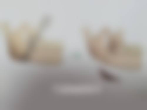 三点双眼皮能否恒久成型?受多种因素影响