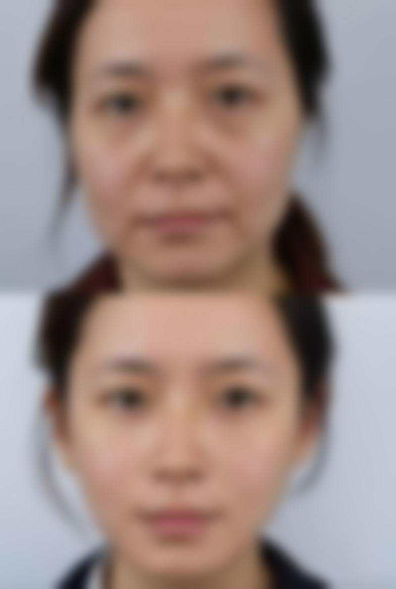 尹婷微医生口碑和评价