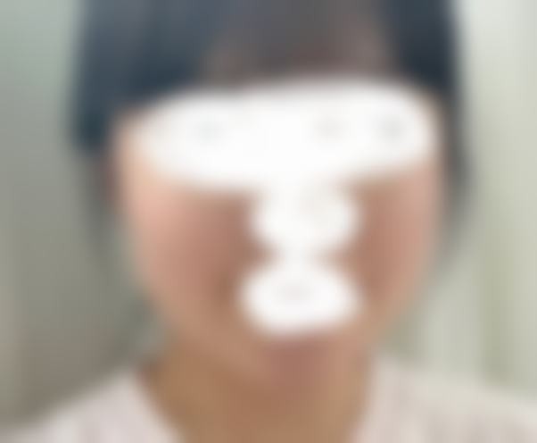 面诊沟通:从“想要自然款”到“精细适配的专属方案”