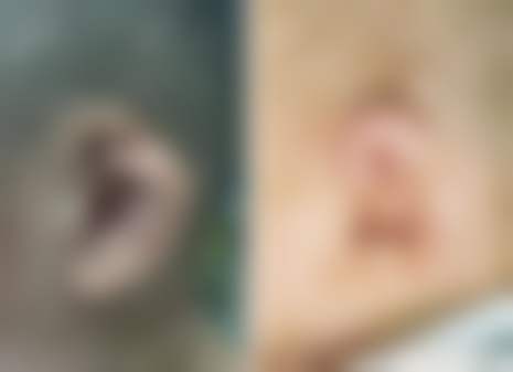 吴念医生在哪家医院怎么预约?