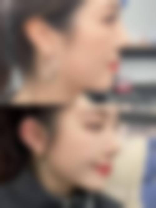 八、深圳壹倍尔医疗美容诊所真实的顾客评价如下: