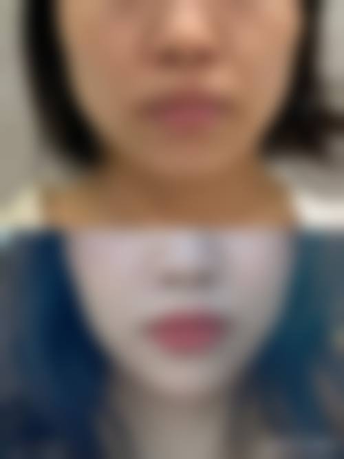 六、深圳壹倍尔医疗美容诊所怎么预约: