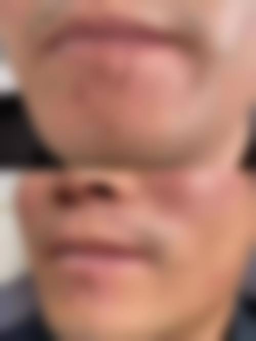 八、四平市中 心医院整形美容外科真实的顾客评价如下: