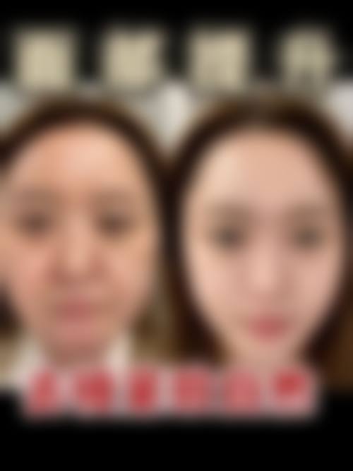 黄建铭医生实例
