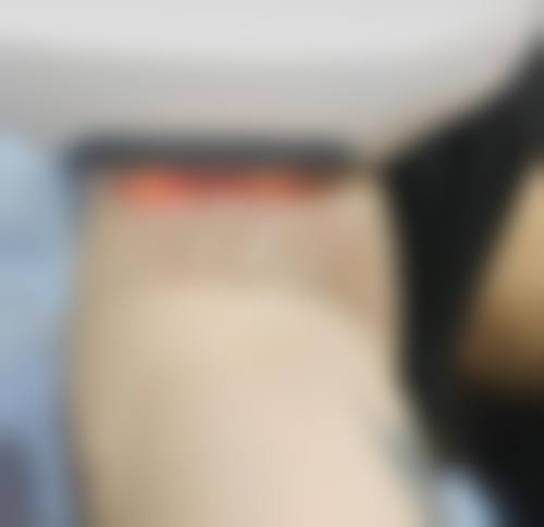 七、亳州宝璋医院皮肤美容科价格表:(仅供参考)