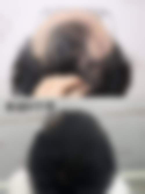 深圳春天阳光医疗美容门诊部蒋瑜审美风格咋样？擅长无创注射塑造自然年轻之美 