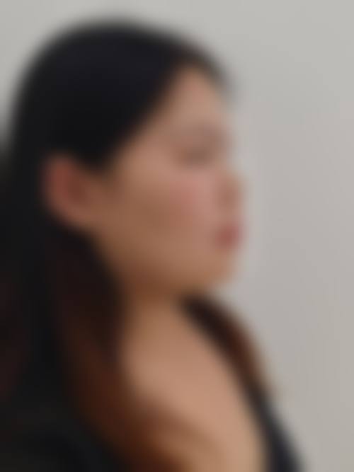 叶亚金医生口碑和评价